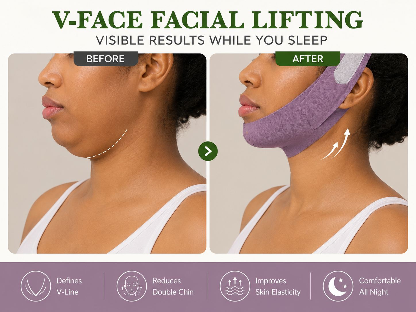 V-Jaw lift™